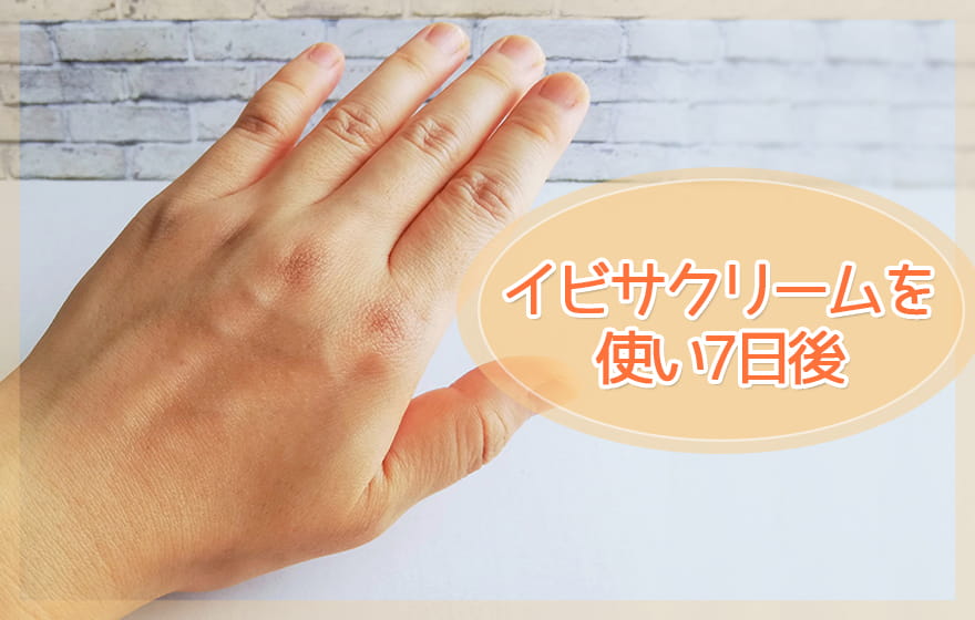 イビサクリームを使い7日後
