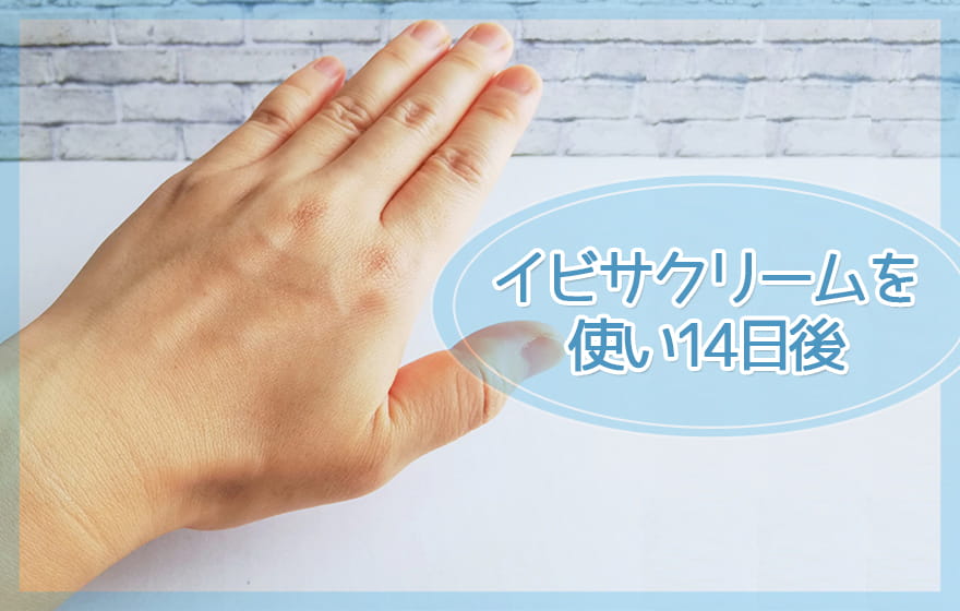 イビサクリームを使い14日後