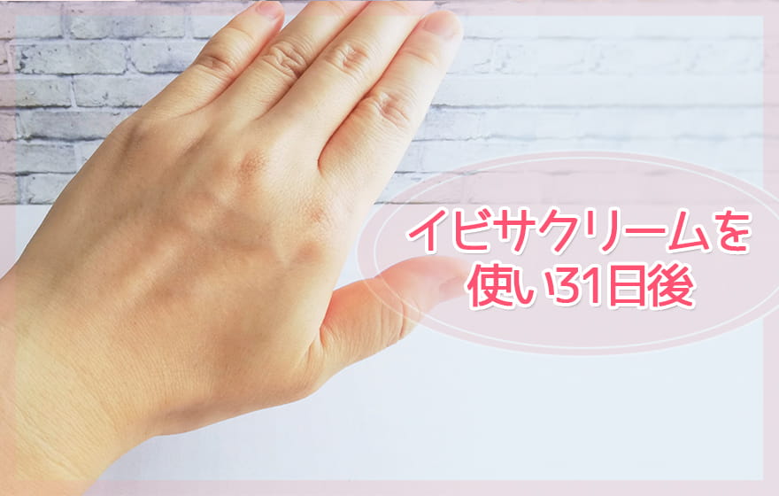イビサクリームを使い31日後